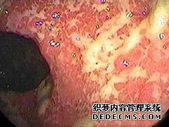 ‌朝阳市泌尿男科医院